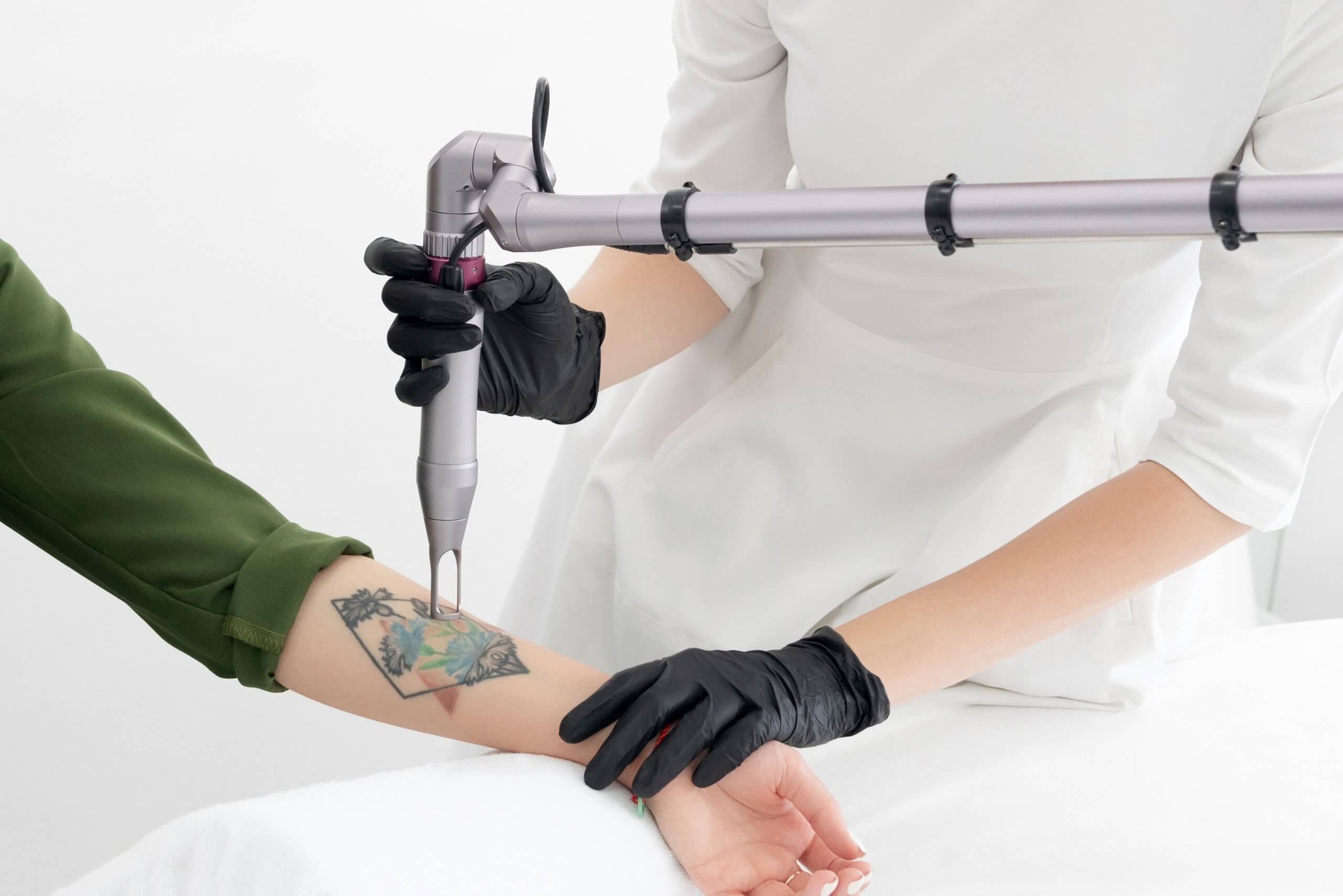 laser tattoo removal careers help rid clients of unwanted tattoos, image of a technician removing a clients tattoo with laser tattoo removal
