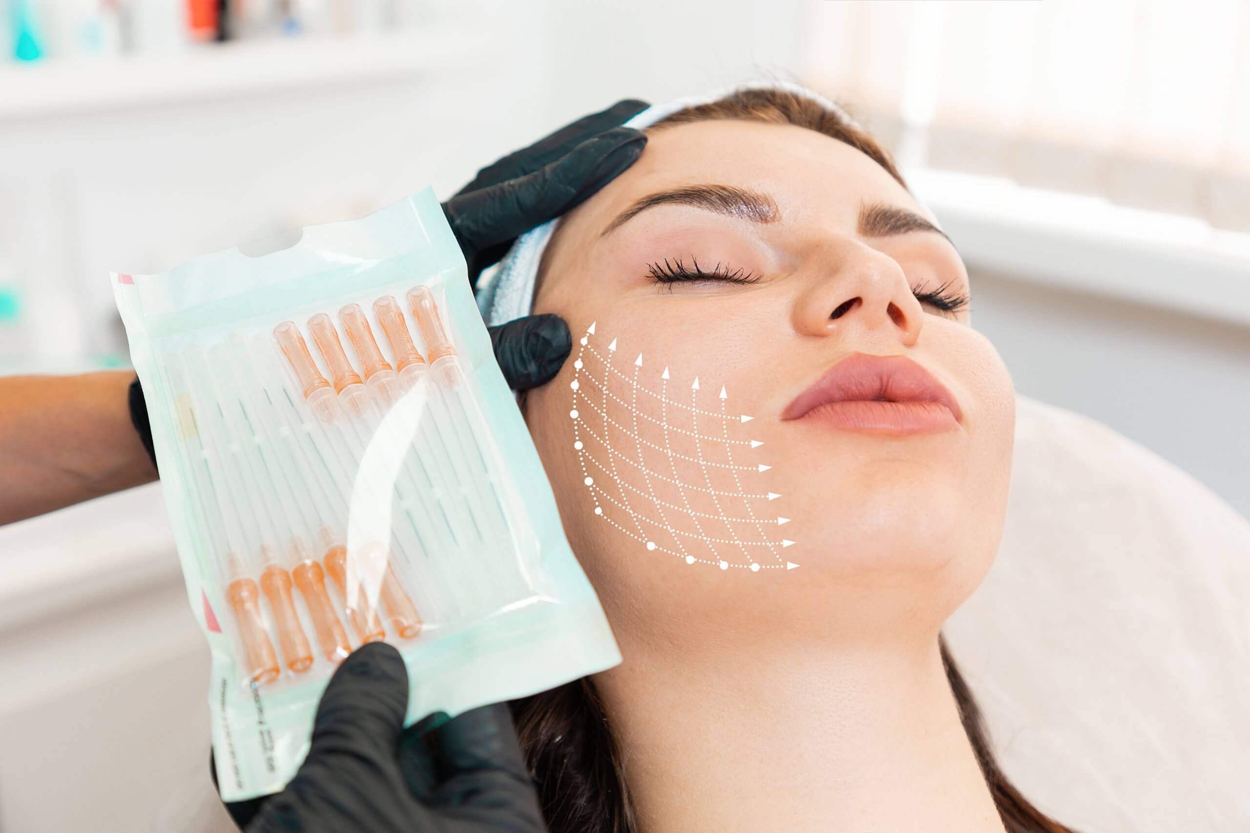 cosmetic injector learns where to place PDO threads as part of medical aesthetic training